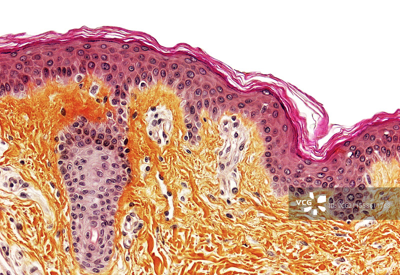 正常人类皮肤，光学显微镜图像图片素材