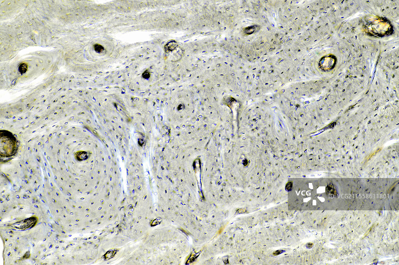紧凑骨，光学显微镜图像图片素材