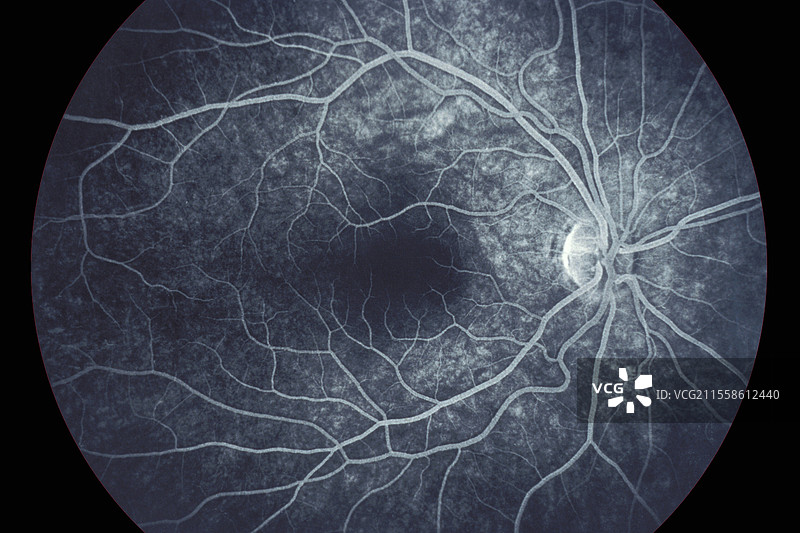 右眼视网膜血管造影图片素材