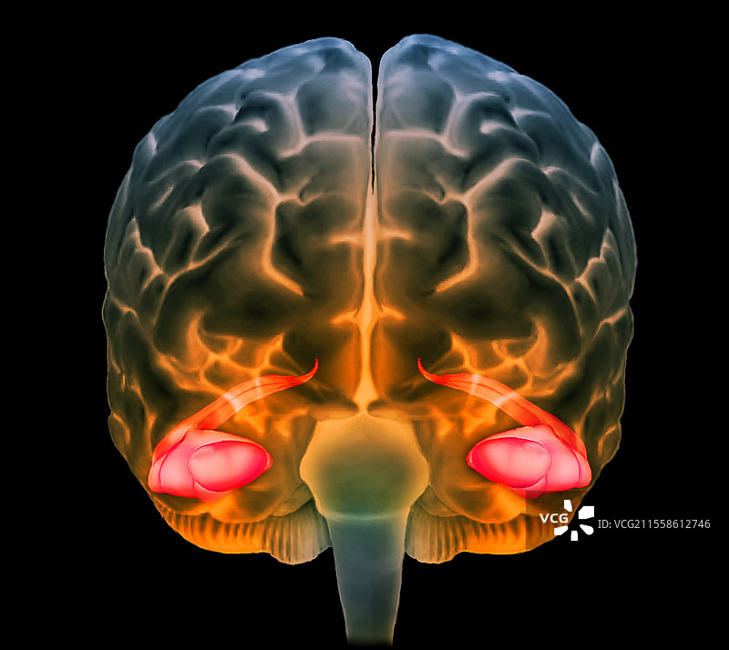 人脑，海马体，3D MRI扫描图片素材