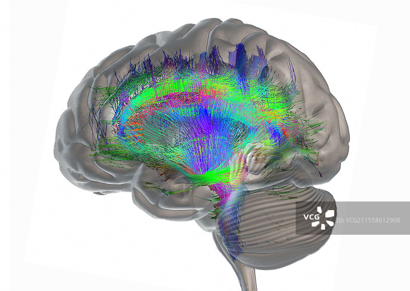 脑纤维和结构，DTI MRI扫描图片素材