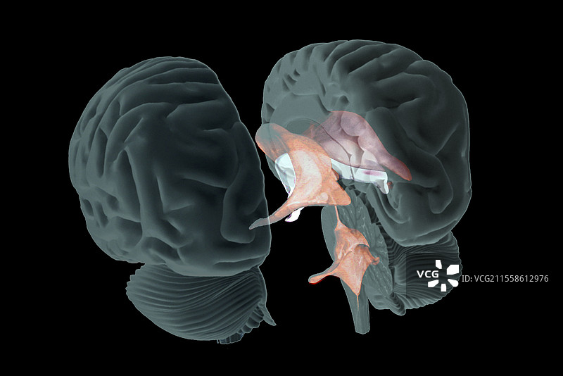 人脑，3D MRI扫描图片素材