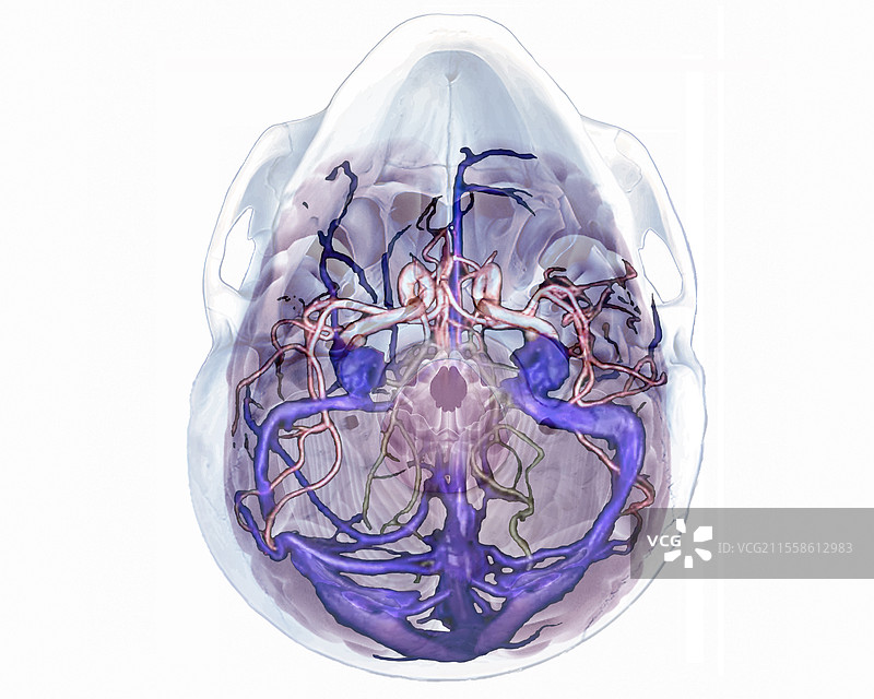 脑动脉和静脉，3D MRI扫描图片素材