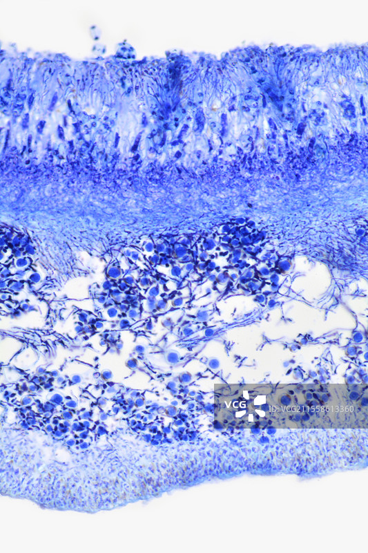 地衣中的真菌果实体，光学显微镜图像图片素材
