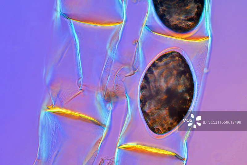 螺旋藻的合子，光学显微镜图像图片素材