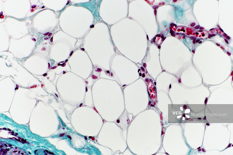 脂肪组织，光学显微镜图像图片素材