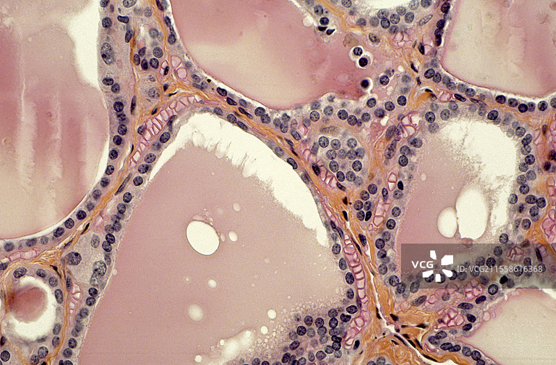 正常甲状腺，光学显微镜下图像图片素材