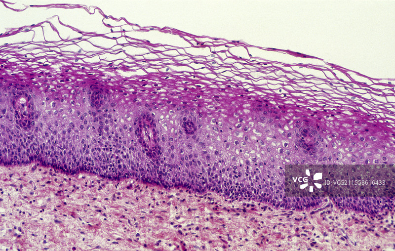 健康的宫颈，光学显微镜图像图片素材