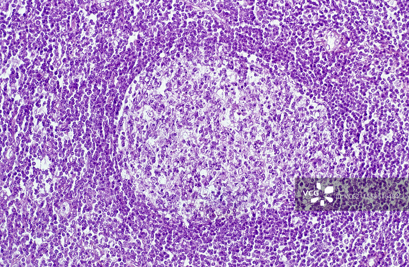 正常淋巴结中的生发中心，光学显微镜图像图片素材