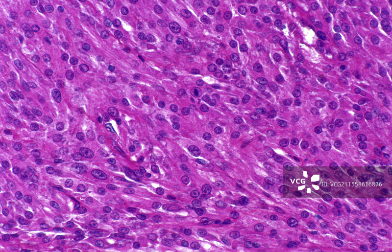 莱迪希细胞肿瘤的光学显微镜图像图片素材