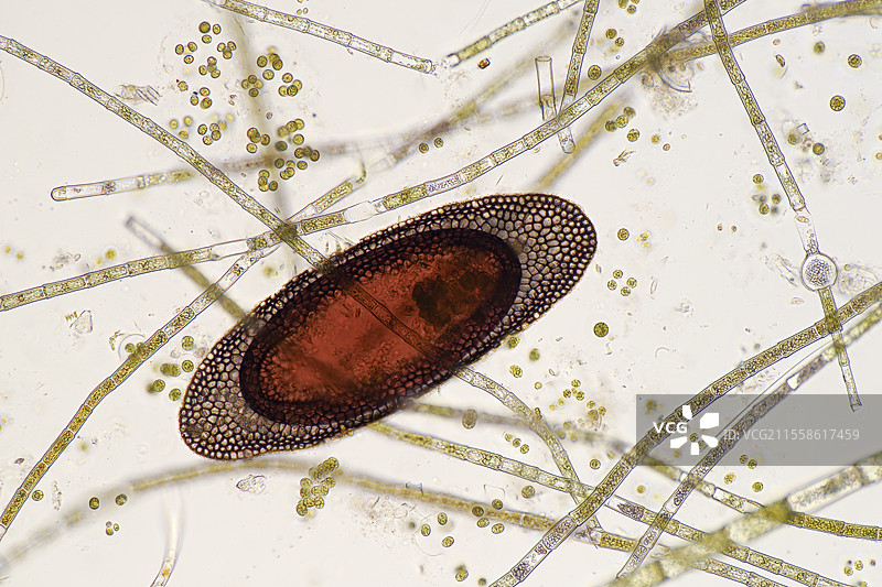 苔藓虫卵和绿藻，光学显微镜图像图片素材