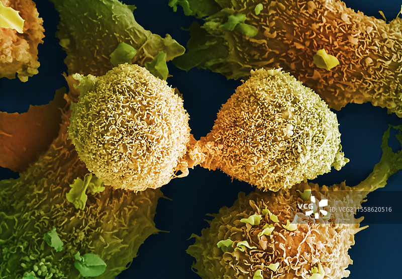 肺癌细胞分裂，扫描电子显微镜图像图片素材