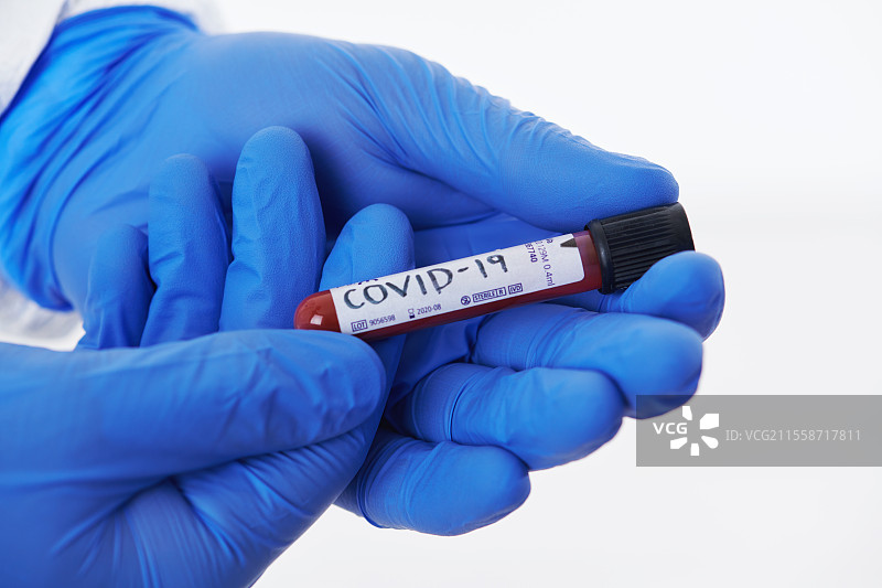 冠状病毒，医生手持阳性新冠病毒血样测试管。穿着生物危害防护口罩、防护服和手套，背景为白色。图片素材