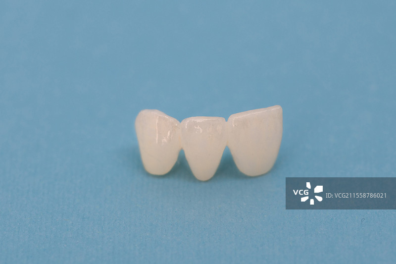 无金属陶瓷牙齿植体牙冠，背景为蓝色，适合高质量的留白照片。无金属陶瓷牙齿植体牙冠，背景为蓝色。图片素材