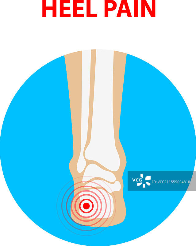 人类脚踝关节后视图的脚跟疼痛图标图片素材