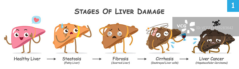 肝损伤的阶段可爱集合图片素材