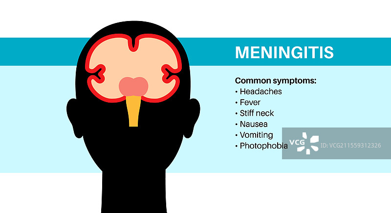 脑膜炎医学海报图片素材