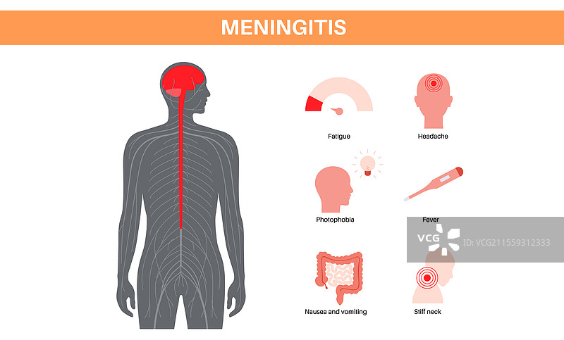 脑膜炎医学海报图片素材