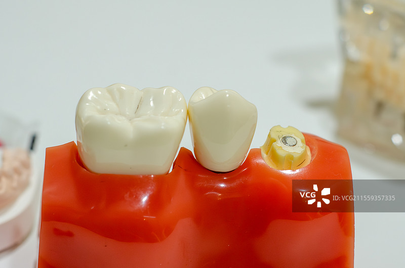 红色基座上的牙齿模型图片素材