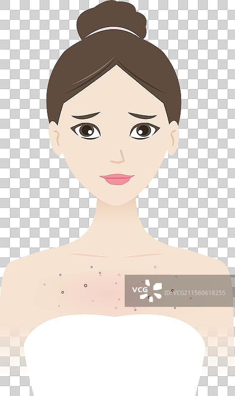 woman with acne on chest图片素材