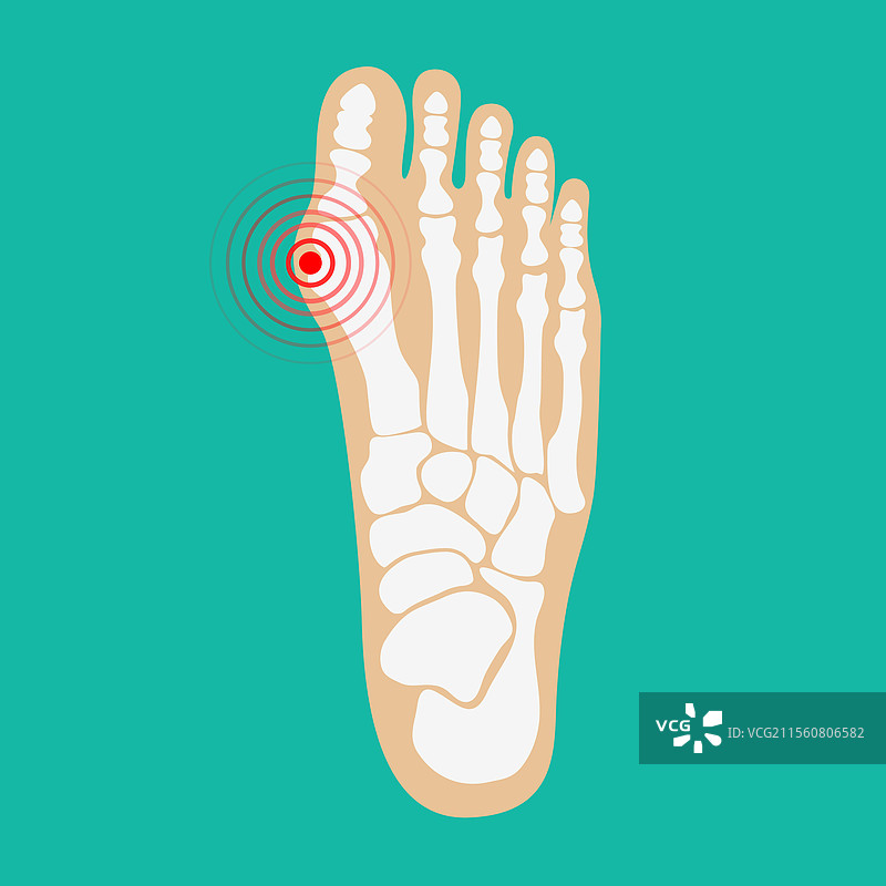 人腿疼痛区域设计元素图片素材