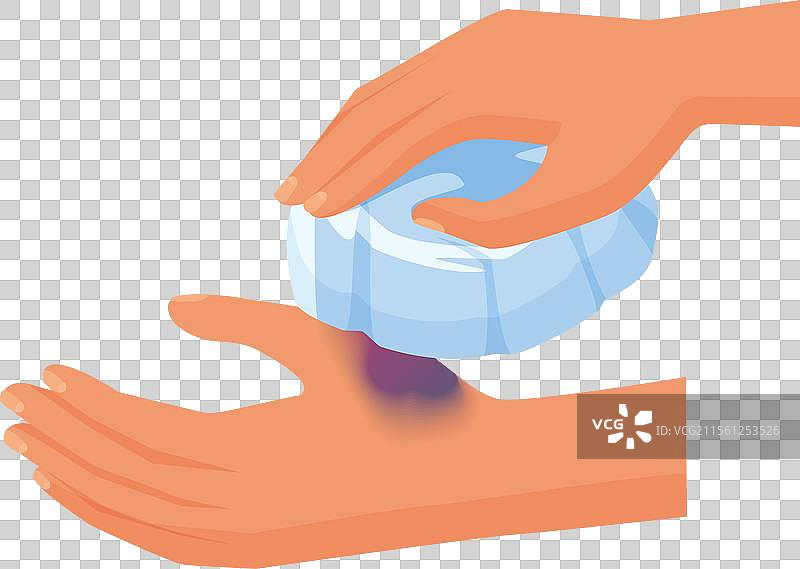 手部将冰袋敷在手臂上的淤伤处以降温图片素材