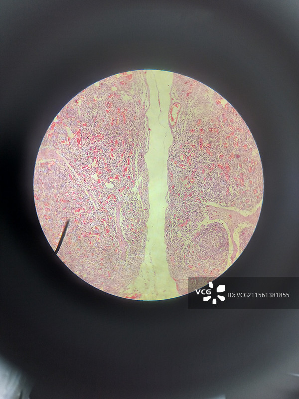 电子显微镜：淋巴结出血图片素材