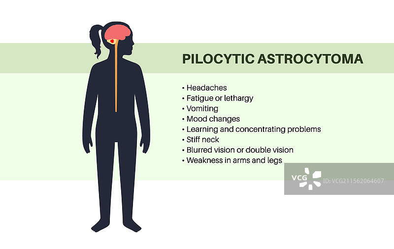 毛细胞星形胶质瘤海报图片素材