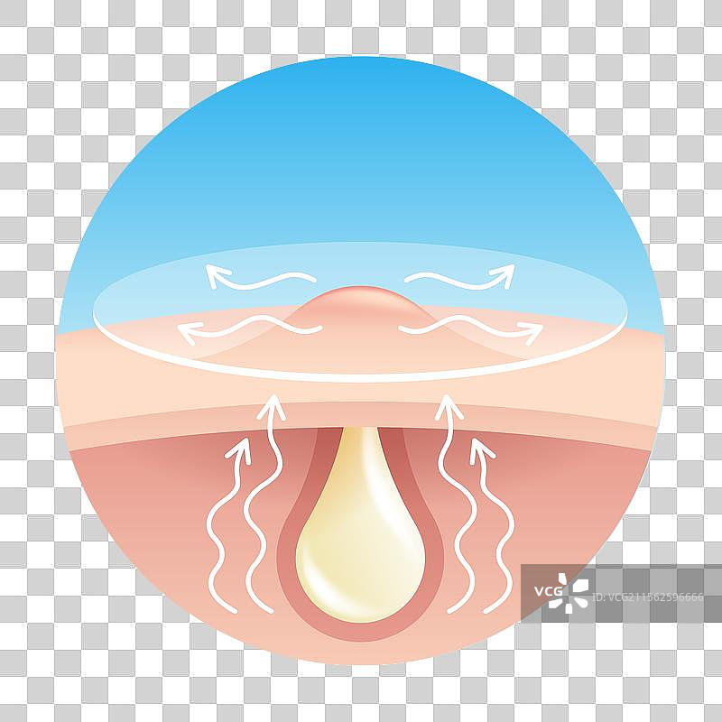 痘痘贴 - 吸收脓液图片素材