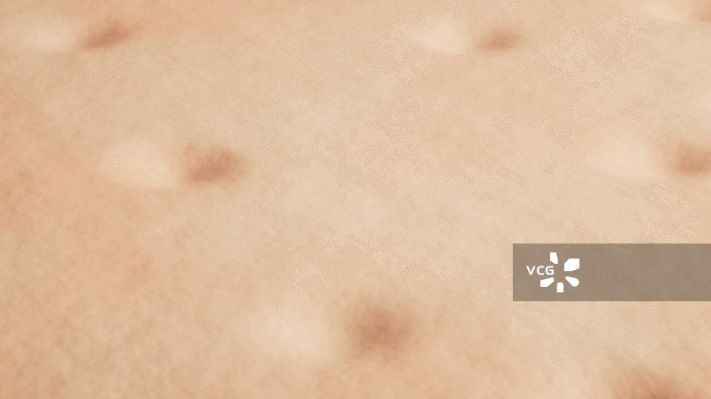 皮肤上的痘痘三维渲染图片素材