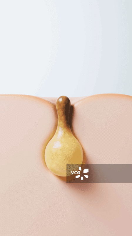 皮肤与毛孔里的粉刺痤疮三维渲染图片素材