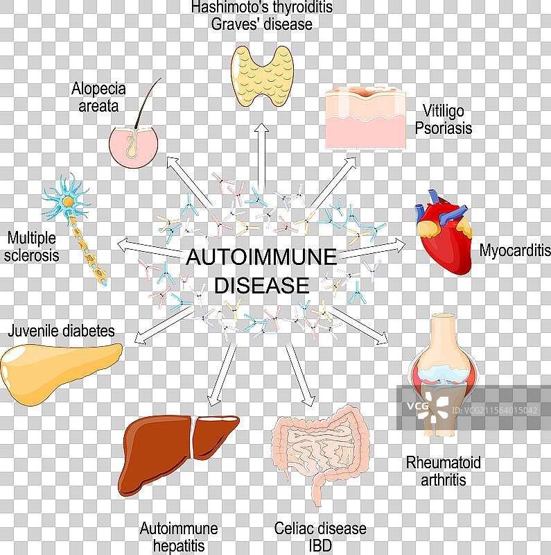 自身免疫性疾病图片素材