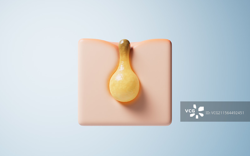 皮肤与毛孔里的粉刺痤疮三维渲染图片素材