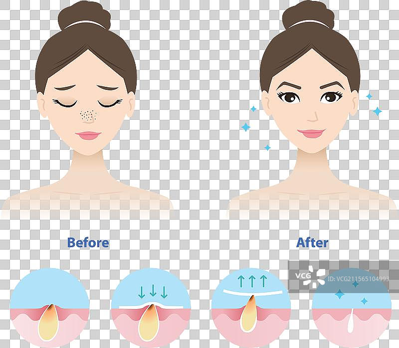 黑头去除前后的对比图片素材