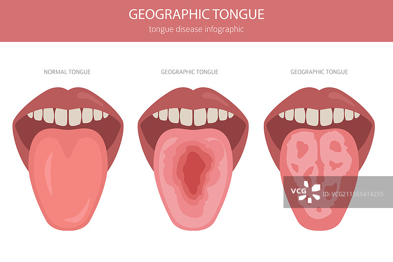 地理舌 1图片素材