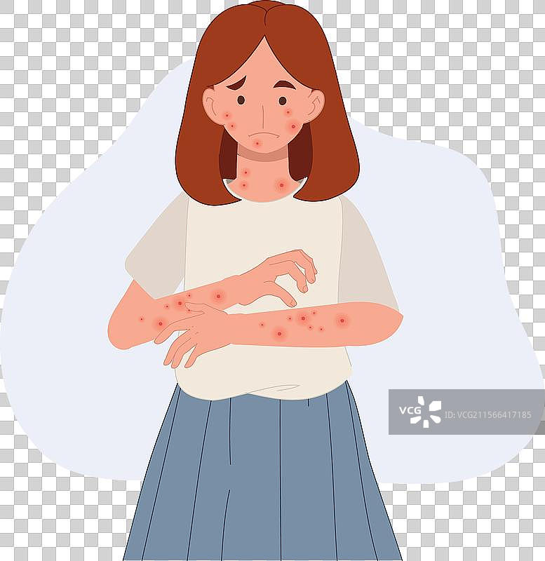 皮肤问题 过敏 健康关注 过敏性图片素材