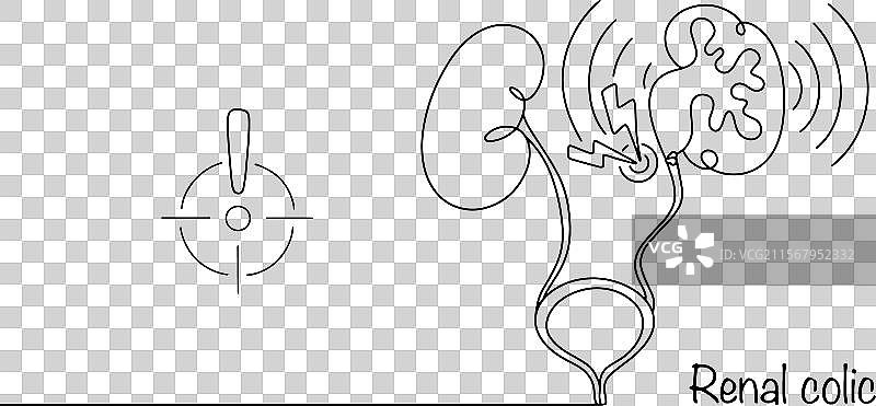 肾绞痛图片素材