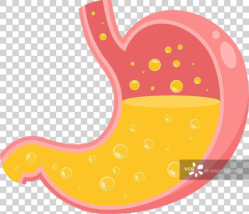 胃酸烧心图解图片素材
