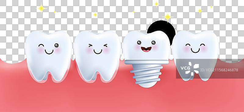 现代牙科植入物骨科治疗图片素材