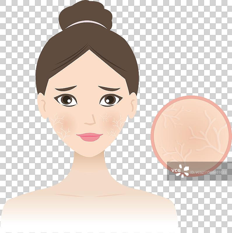面部皮肤干燥的女性图片素材