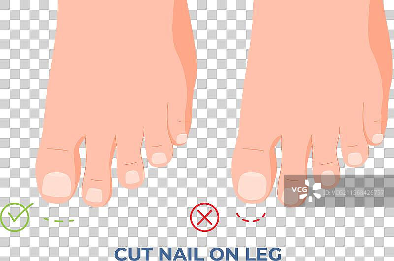 如何正确剪趾甲以避免疼痛图片素材