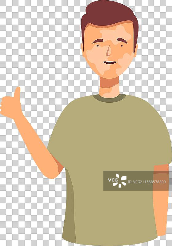 微笑的年轻人有白癜风，正在竖起大拇指。图片素材