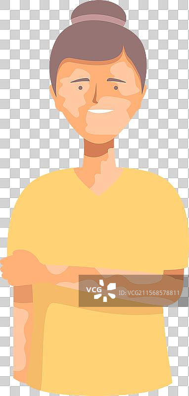 年轻自信的护士，面带微笑，皮肤有白癜风。图片素材