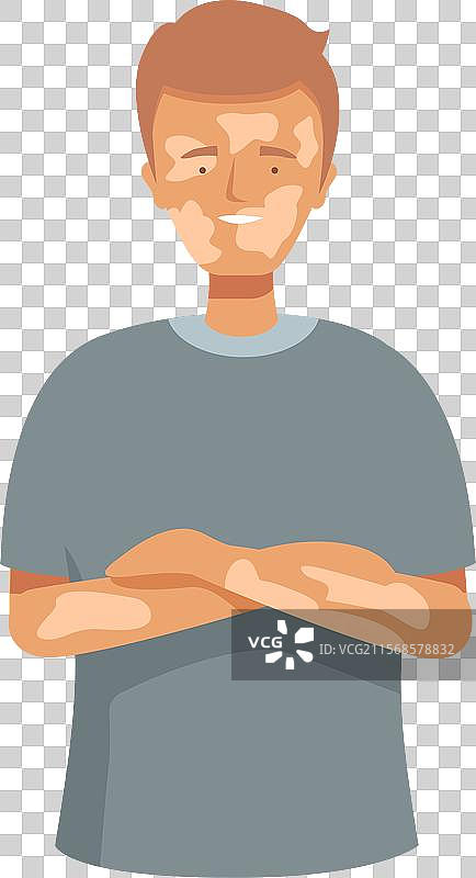 微笑的年轻男性，皮肤有白癜风状况图片素材