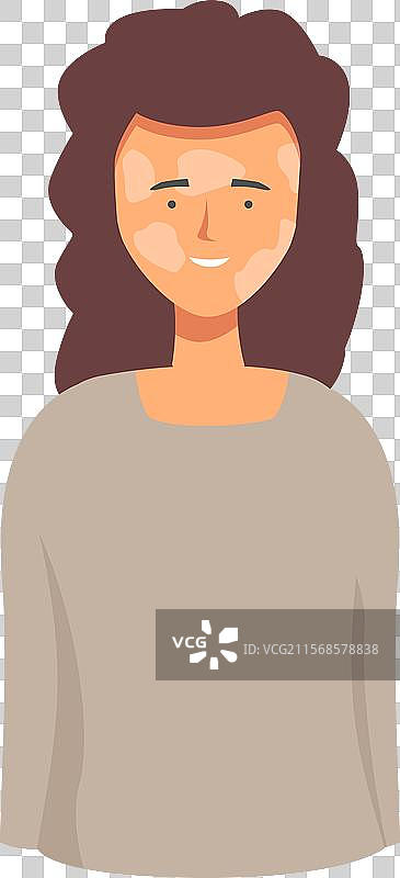 微笑并感受的年轻女性，患有白癜风图片素材