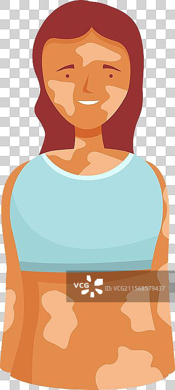 微笑并感到愉悦的年轻女性，皮肤有白癜风。图片素材