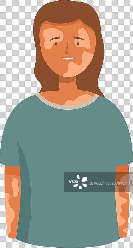 微笑的年轻女性，皮肤有白癜风状况图片素材