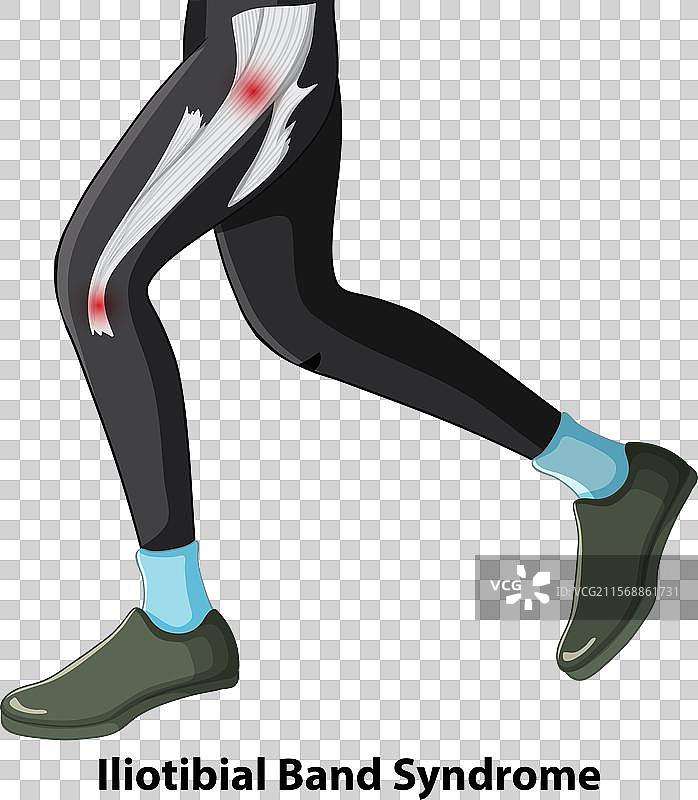 膝盖和大腿疼痛的描绘图片素材