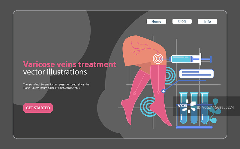 专业的静脉曲张治疗 医疗图片素材