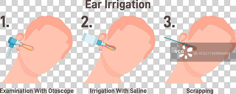 耳鼻喉科医生为病人冲洗耳朵，医生正在检查耳朵图片素材